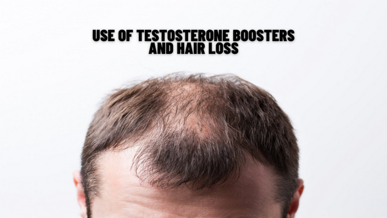Does Use of Testosterone Boosters Result In Hair Loss? Know Science